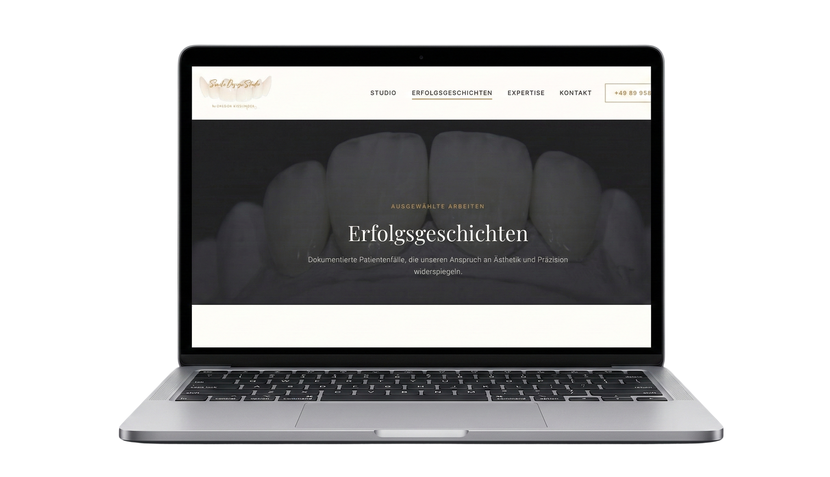 Webdesign Referenz – Smile Design Studio